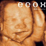 centro ecografía prenatal 4D