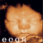 centro ecografía prenatal 4D